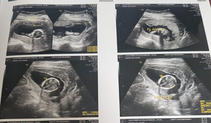 A vinda do tão esperado Guilherme