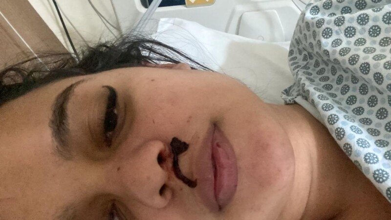 Apoie a luta da Emília contra uma doença autoimune.