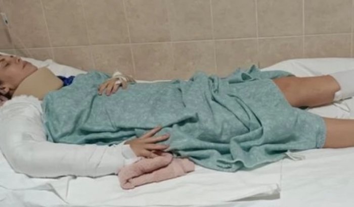 Ajude Isabela a fazer cirurgia de urgência na coluna e clavícula em Lima no Peru
