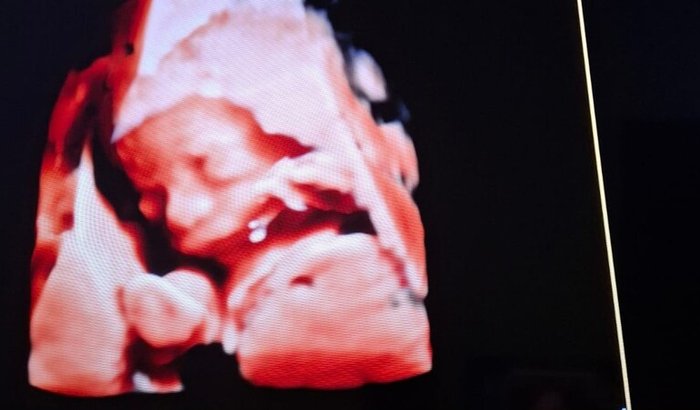 ✨ Um sonho por uma vida melhor ✨