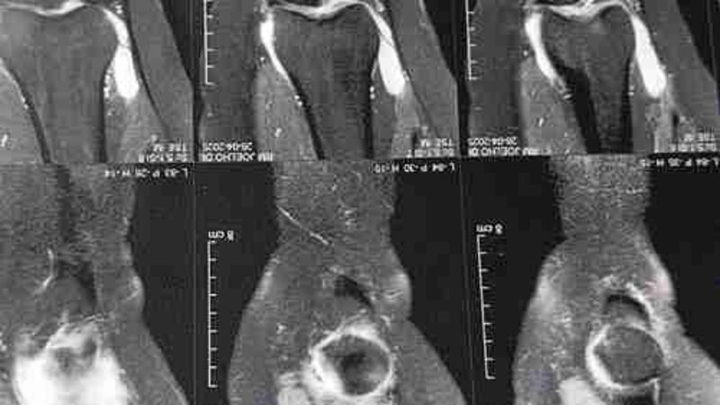 imagem da vaquinha Ajuda para fazer uma cirurgia 