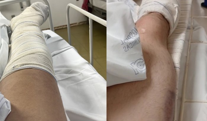Acidente Cauã e Gi