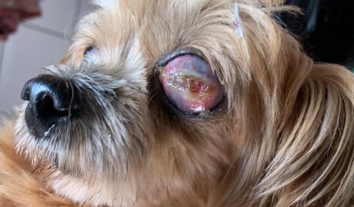 Cirurgia Enucleação (retirada do globo ocular) MEL