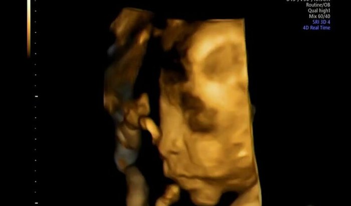 Grávida e sem renda: Ajude a realizar meu sonho