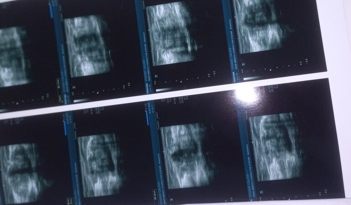 Ajudar para fazer uma cirurgia para retirada de um nódulo