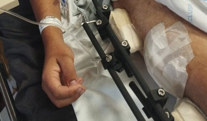Recuperação do Matheus