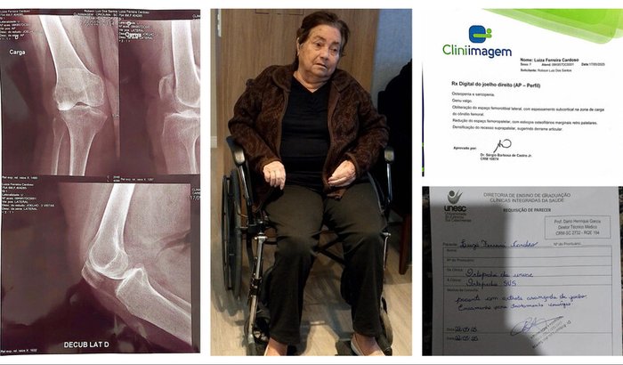 Ajude a Luiza a voltar a caminhar - artroplastia no joelho