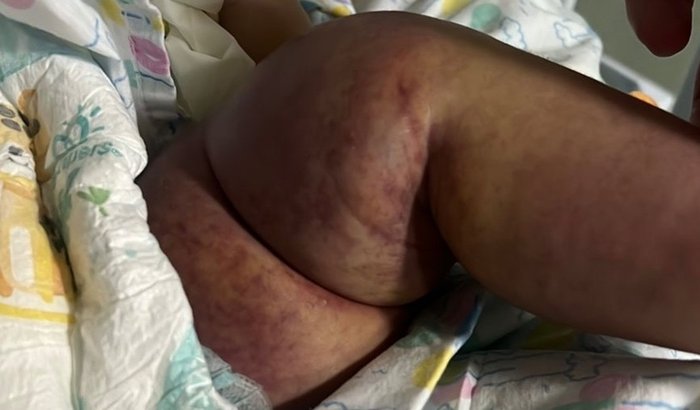 A luta da pequena Maria Luiza