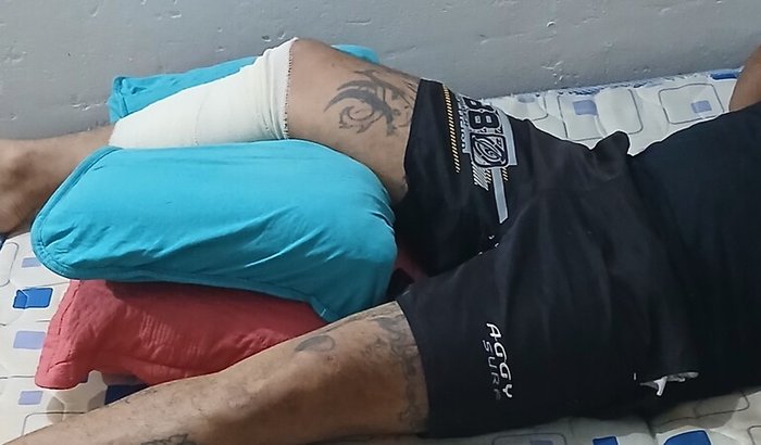 Remedio acidente de moto e alimentação 