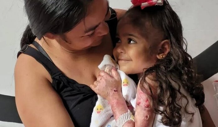 Ajude a Wendy, criança com EB 