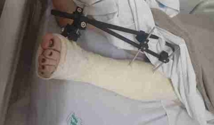 Ajuda medicamentos, cirurgia.