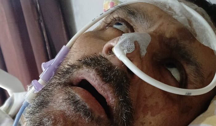 Grande queimadura, parada cardíaca, vegetativo.