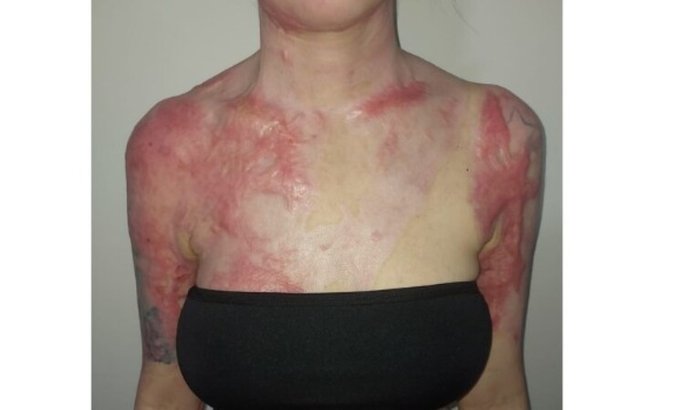 Malhas, curativos, amor e esperança: ajude na minha recuperação