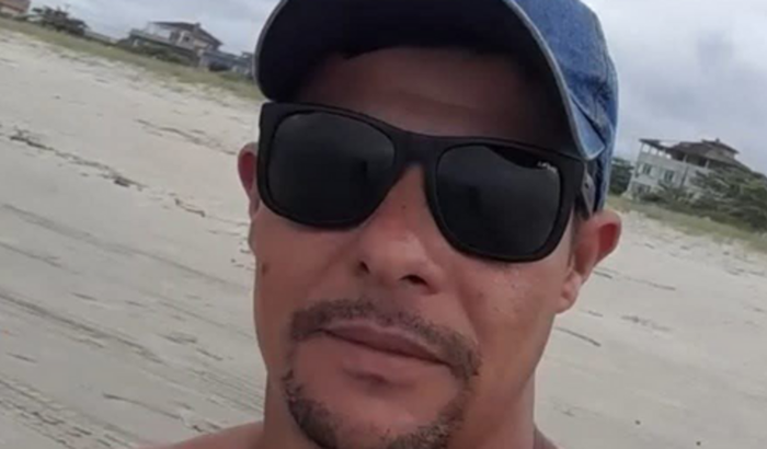 Cirurgia complexa de mandíbula do Anderson Neves