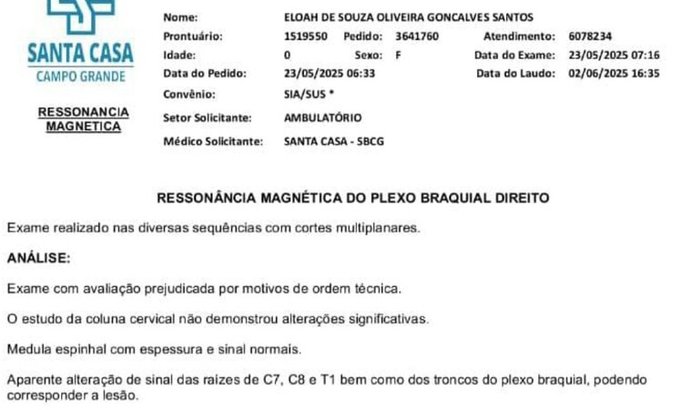 Cirurgia Do Plexo Braquial Da Eloah