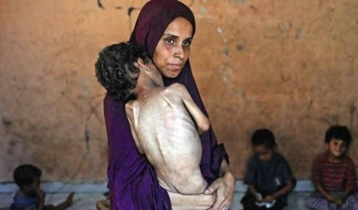 A Fome Não Pode Esperar 