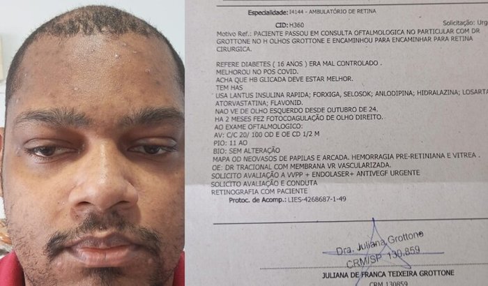 Cirurgia nos Olhos