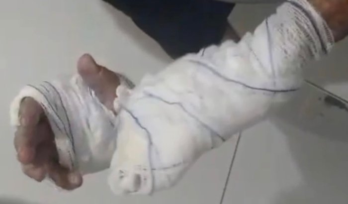 Mãos que Consertam, Agora Precisam de Cuidado