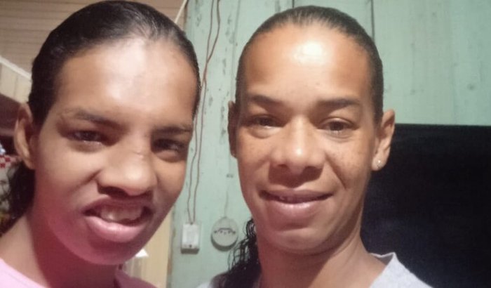 Vaquinha da Scooter da Rô