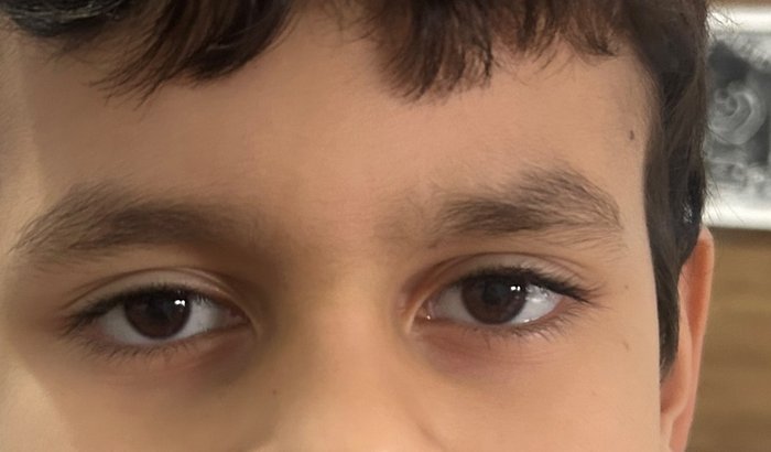 Ajuda para o tratamento do João Lucas