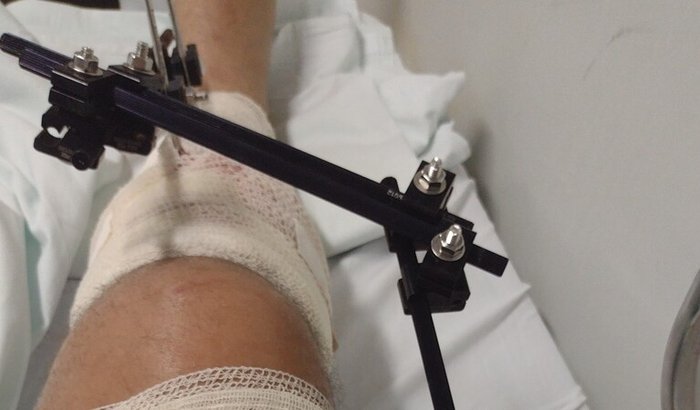 Ajuda no tratamento e recuperação