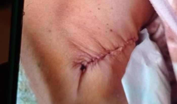 Vaquinha para despesas medicas , tratamento de câncer de mama