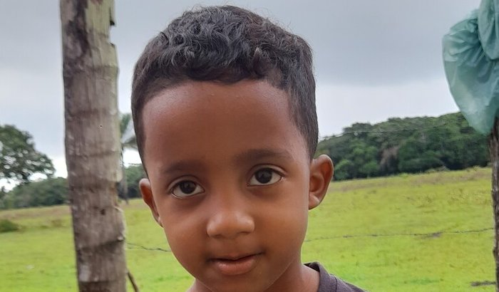 Cirurgia de Adenoamigdalectomia