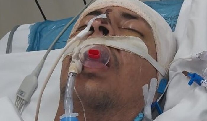 TODOS PELO RAFA