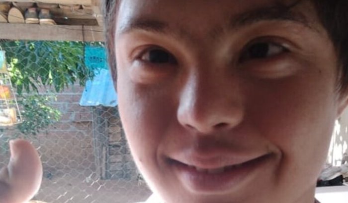 Ajuda para cirurgia do Efraim