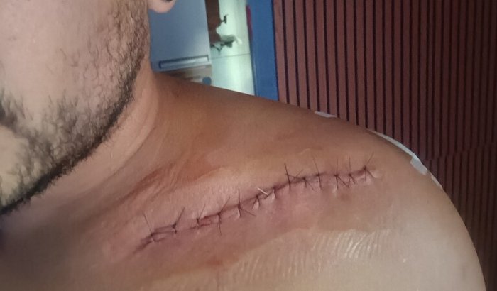 Sofri um acidente de bicicleta e não posso trabalhar AJUDEM