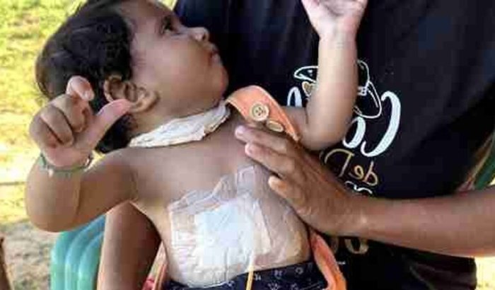 Ajuda para ajudar na alimentação do Gael