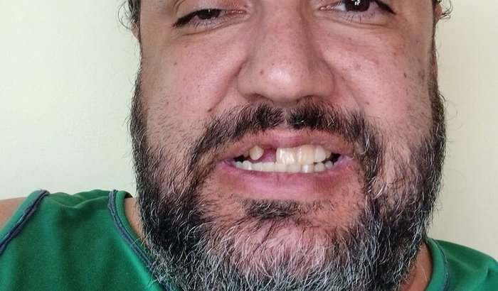 Tratamento dentário urgente 