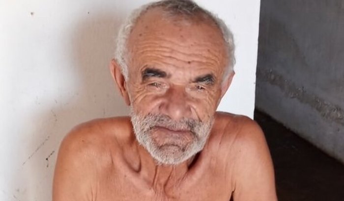 Ajude a realizar cirurgia de glaucoma de José Paulino 