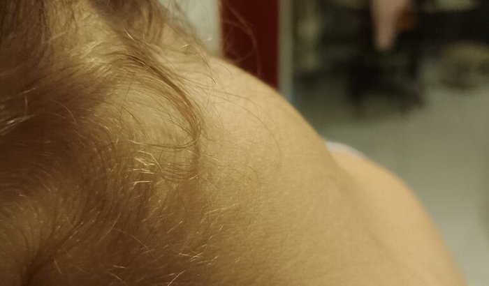 Contribuição para cirurgia da Luísa