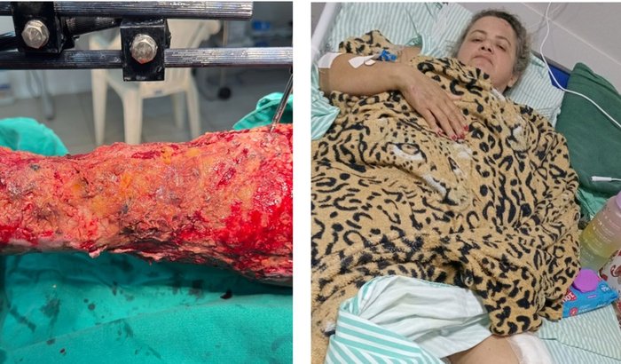 Ajude na recuperação da Doca