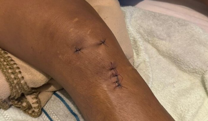 Ajuda na recuperação da Eliane 