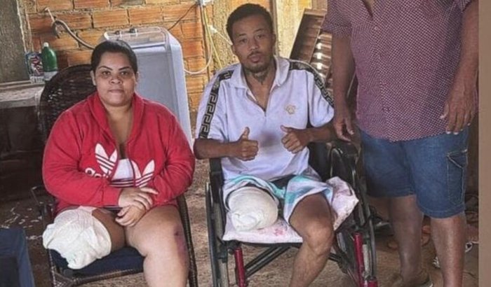 Ajuda pra compra minha prótese