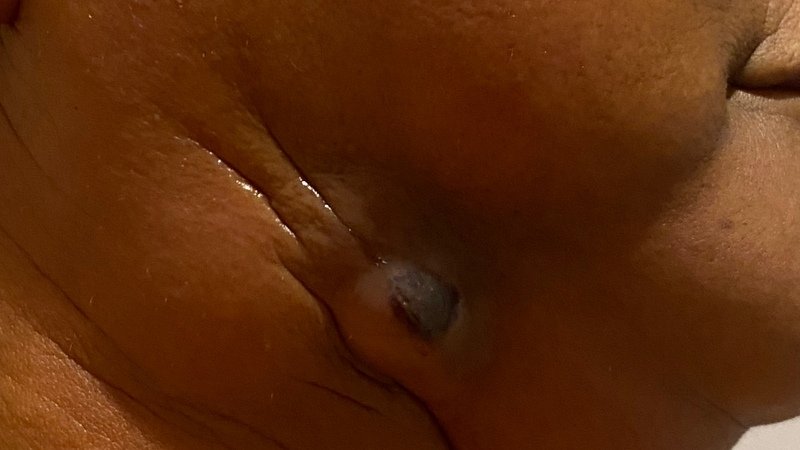 imagem da vaquinha Ajuda para o tratamento da minha mãe 