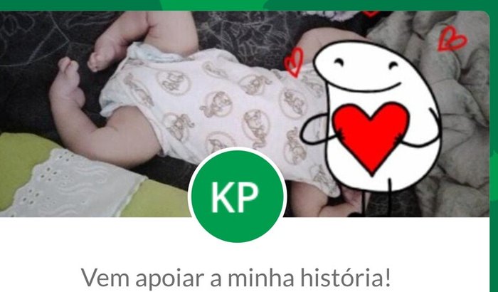 Cirurgia de pé torto congênito do Anthony 