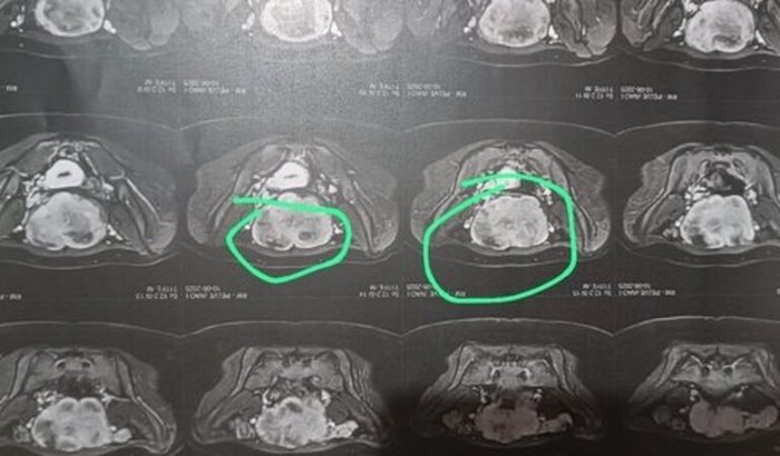 Cirurgia da Maria Clara