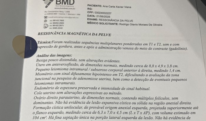 Cirurgia para retirada de um tumor no ovário