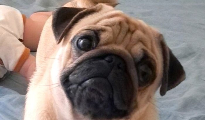 CIRURGIA DE HIDROCEFALIA DO PARAFINA