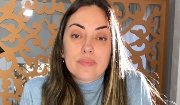 AJUDE A SIMONE A REALIZAR NEUROCIRURGIA URGENTE