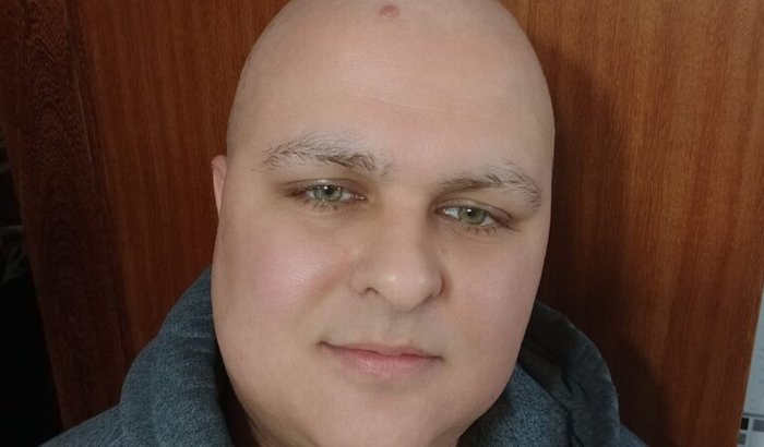 Cirurgia contra câncer nos gânglios do Wagner Santos Maria 