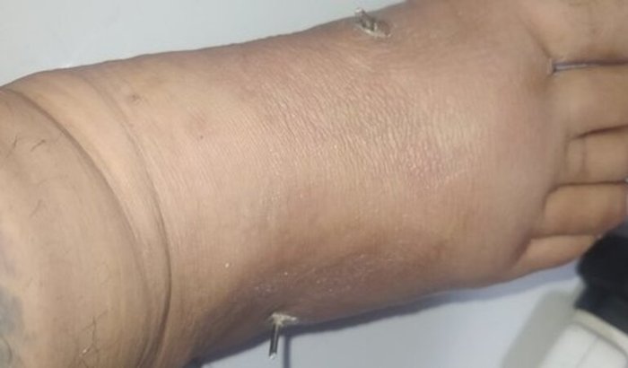 Auxílio para os dias de recuperação 