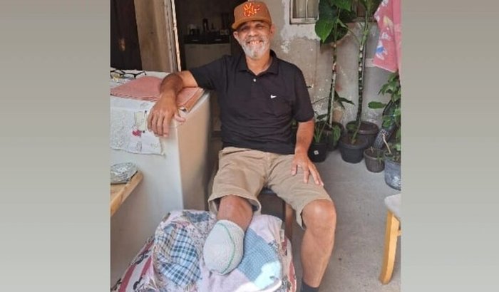 Prótese Trans tibial 
