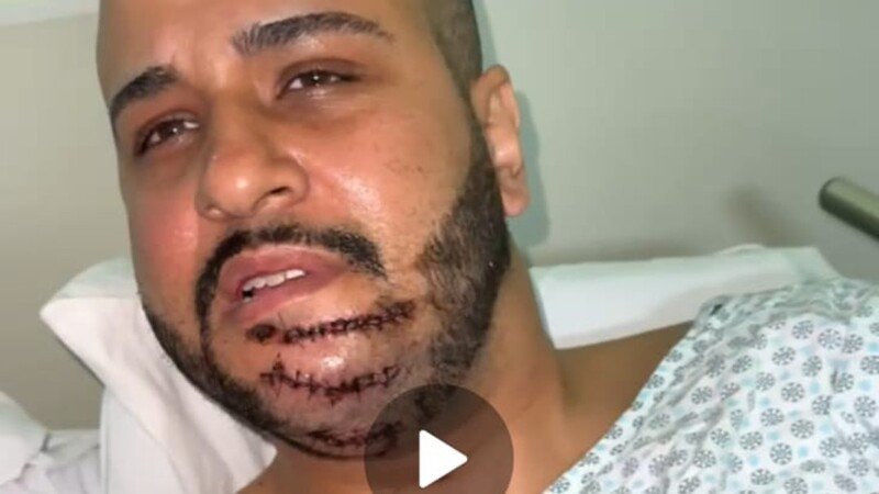 imagem da vaquinha AJUDA PARA ME RESTABELECER FISICAMENTE E FINANCEIRAMENTE APÓS ACIDENTE DE MOTO