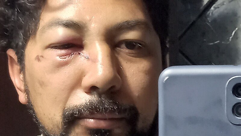 imagem da vaquinha Vakinha para Cirurgia