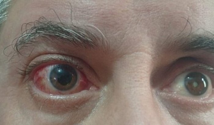 Ajude Júnior a Salvar sua única visão