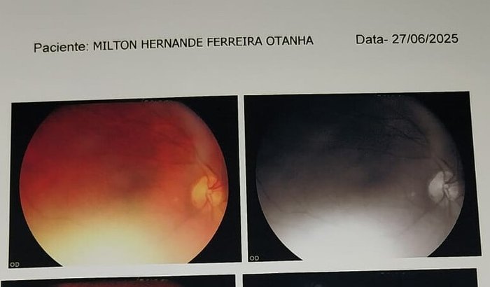 Ajude o Milton a recuperar a visão!